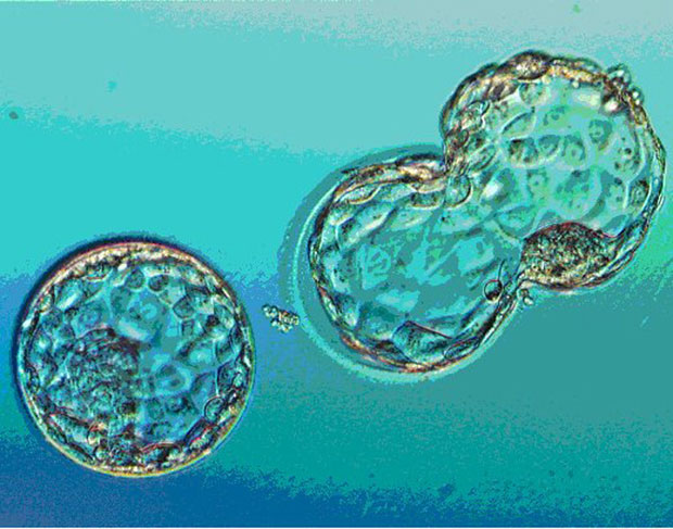 На лед само ембриони из вантелесне